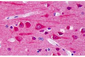 Human Brain, Cortex: Formalin-Fixed, Paraffin-Embedded (FFPE) (CAMK2B 抗体  (pThr286))