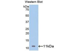 Western blot analysis of the recombinant protein. (IGF2 抗体  (AA 25-91))