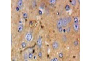 Used in DAB staining on fromalin fixed paraffin-embedded Brain tissue (HSPA4 抗体  (AA 258-511))
