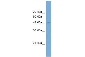 WB Suggested Anti-NPTX2 Antibody Titration: 0. (NPTX2 抗体  (Middle Region))