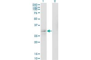 Western Blot analysis of ASCL1 expression in transfected 293T cell line by ASCL1 polyclonal antibody (A01). (ASCL1 抗体  (AA 137-236))