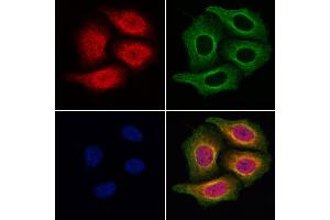 ABIN6257303 and ABIN6275012 staining Hela cells by IF/ICC. (KIF4A 抗体  (C-Term))
