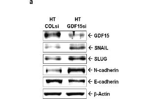 Expression of GDF15 modulates the expression of epithelial-mesenchymal transition markers in human HT1376 cells.