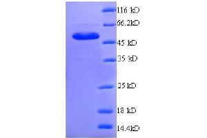 SDS-PAGE (SDS) image for Endoplasmic Reticulum Protein 29 (ERP29) (AA 40-251), (partial) protein (GST tag) (ABIN7479314)