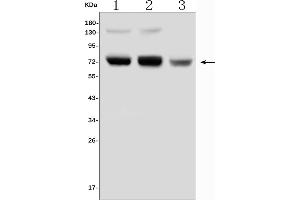 Western blot analysis of PRMT5 using anti-PRMT5 antibody (ABIN7600350).