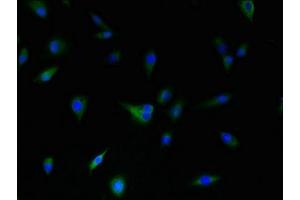 Immunofluorescent analysis of U87 cells using ABIN7149470 at dilution of 1:100 and Alexa Fluor 488-congugated AffiniPure Goat Anti-Rabbit IgG(H+L) (DRD5 抗体  (AA 361-477))