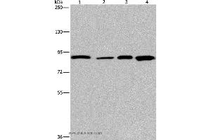 Western blot analysis of Mouse heart tissue and Hela cell, HUVEC cell and mouse skin tissue, using JUP Polyclonal Antibody at dilution of 1:1150 (JUP 抗体)