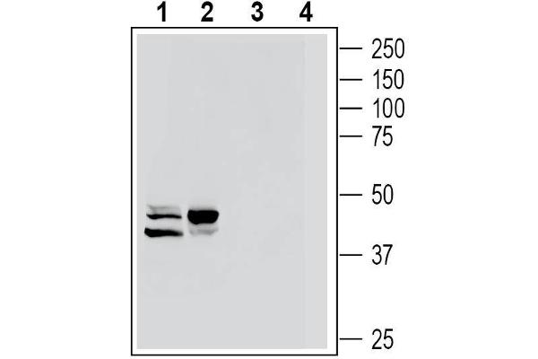 GPR77 抗体  (Extracellular)
