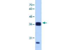 Western Blot analysis of Raji cell lysate with HNRNPH3 polyclonal antibody  at 1 ug/mL working concentration. (HNRNPH3 抗体  (N-Term))