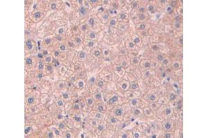 IHC-P analysis of liver tissue, with DAB staining. (Asialoglycoprotein Receptor 2 抗体  (AA 1-311))