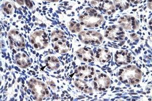 Image no. 1 for anti-Sp7 Transcription Factor (SP7) (C-Term) antibody (ABIN6735947) (SP7 抗体  (C-Term))