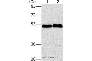 Western blot analysis of Mouse brain and liver tissue, using SPHK2 Polyclonal Antibody at dilution of 1:200 (SPHK2 抗体)