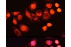 Immunofluorescence analysis of HeLa cells using HRAS Polyclonal Antibody at dilution of 1:100 (40x lens). (HRAS 抗体)