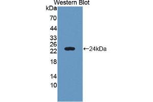 Western blot analysis of the recombinant protein. (C6orf150 抗体  (AA 225-407))