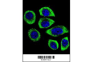 Confocal immunofluorescent analysis of PIP5KL1 Antibody with U-251MG cell followed by Alexa Fluor 488-conjugated goat anti-rabbit lgG (green). (PIP5KL1 抗体  (N-Term))