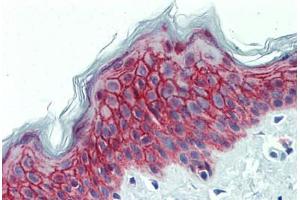 Human Skin: Formalin-Fixed, Paraffin-Embedded (FFPE) (GALR2 抗体  (AA 212-277))