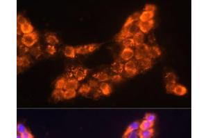 Immunofluorescence analysis of A431 cells using LAMC2 Polyclonal Antibody at dilution of 1:100 (40x lens). (LAMC2 抗体)