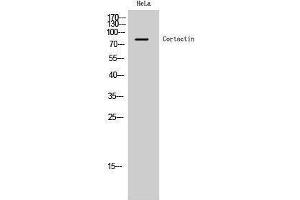 Western Blotting (WB) image for anti-Cortactin (CTTN) (Ser338) antibody (ABIN3174520) (Cortactin 抗体  (Ser338))