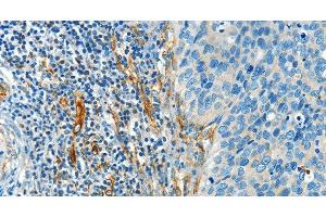 Immunohistochemistry (Paraffin-embedded Sections) (IHC (p)) image for anti-Deiodinase, Iodothyronine, Type II (DIO2) antibody (ABIN7238897)