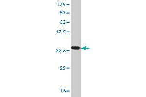 Western Blot detection against Immunogen (34. (slc25a13 抗体  (AA 2-80))