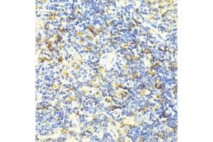 Immunohistochemistry of paraffin-embedded mouse spleen using ARRB1 antibody. (beta Arrestin 1 抗体  (AA 169-418))