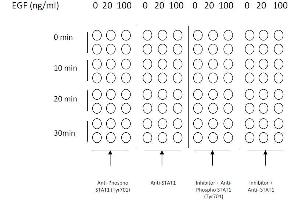 Image no. 4 for Signal Transducer and Activator of Transcription 1, 91kDa (STAT1) ELISA Kit (ABIN1981837)