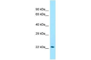Western Blotting (WB) image for anti-ST6 beta-Galactosamide alpha-2,6-Sialyltranferase 1 (ST6GAL1) (C-Term) antibody (ABIN2789724) (ST6GAL1 抗体  (C-Term))