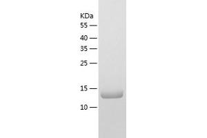 Western Blotting (WB) image for Thioredoxin Reductase 3 Neighbor (TXNRD3NB) (AA 1-133) protein (His tag) (ABIN7125364) (TXNRD3NB Protein (AA 1-133) (His tag))