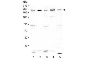Western blot testing of human 1) HeLa, 2) COLO320, 3) 293T, 4) Jurkat and 5) mouse testis lysate with ASXL1 antibody at 0. (ASXL1 抗体)