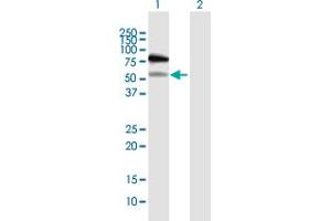 Western Blot analysis of RAD18 expression in transfected 293T cell line by RAD18 MaxPab polyclonal antibody. (RAD18 抗体  (AA 1-495))