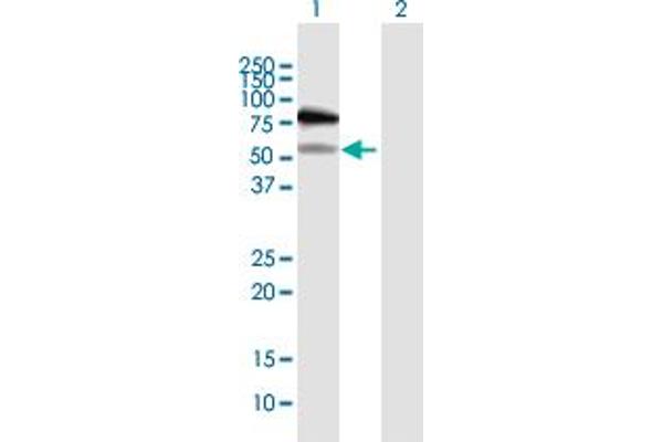 RAD18 Antikörper  (AA 1-495)