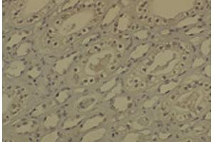 IHC analysis of DNMT1 in medullar kidney tissue sections using DNMT / DNMT1 antibody. (DNMT1 抗体  (AA 637-650) (PerCP))