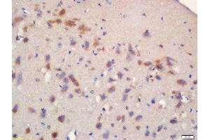 Formalin-fixed and paraffin embedded rat brain labeled with Rabbit Anti-mTOR (Ser2481) Polyclonal Antibody, Unconjugated 1:200 followed by conjugation to the secondary antibody and DAB staining (MTOR 抗体  (pSer2481))