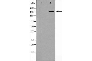 Western blot analysis of extracts of mouse lung, using DLC1 antibody. (DLC1 抗体  (N-Term))