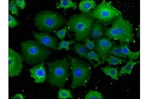 Immunofluorescence staining of A549 cells with ABIN7151958 at 1:100, counter-stained with DAPI. (Epsin 2 抗体  (AA 15-300))