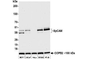 Western Blotting (WB) image for anti-Epithelial Cell Adhesion Molecule (EPCAM) (AA 24-265) antibody (ABIN7455170) (Recombinant EpCAM 抗体  (AA 24-265))