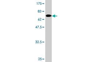 Western Blot detection against Immunogen (69. (TCN2 抗体  (AA 1-400))