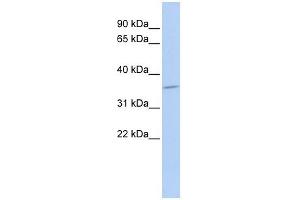 SULT1C4 antibody used at 1 ug/ml to detect target protein. (SULT1C4 抗体  (Middle Region))