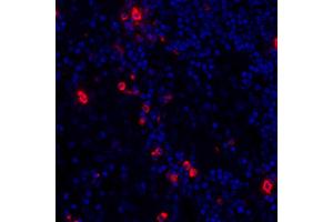 Immunofluorescence (IF) image for anti-Granzyme B (GZMB) (AA 19-247) antibody (ABIN7449554) (Recombinant GZMB 抗体  (AA 19-247))