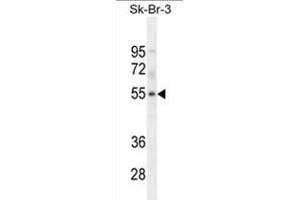 WDR21B Antibody (C-term) western blot analysis in SK-BR-3 cell line lysates (35 µg/lane). (DCAF4L1 抗体  (C-Term))
