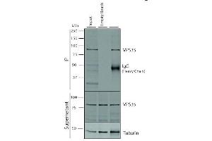 Immunoprecipitation analysis using Mouse Anti-VPS35 Monoclonal Antibody, Clone 5A9 (ABIN6932932). (VPS35 抗体)