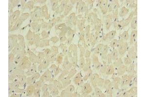 Immunohistochemistry of paraffin-embedded human heart tissue using ABIN7159179 at dilution of 1:100 (MEI1 抗体  (AA 1-238))