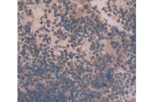 Immunohistochemistry (IHC) image for anti-Ninein (GSK3B Interacting Protein) (NIN) (AA 1-153) antibody (ABIN5014013)