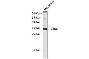 Western blot analysis of extracts of Mouse liver using C1QB Polyclonal Antibody at dilution of 1:1000. (C1QB 抗体)
