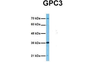 Host:  Rabbit  Target Name:  GPC3  Sample Tissue:  Human Adult Placenta  Antibody Dilution:  1. (Glypican 3 抗体  (Middle Region))