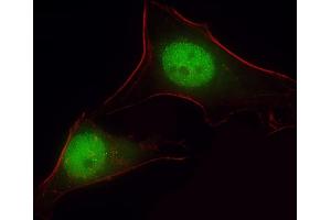 Immunofluorescent analysis of 4 % paraformaldehyde-fixed, 0. (ARHGAP39 抗体  (C-Term))