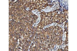 IHC analysis of CBR1 using anti-CBR1 antibody (ABIN7600015). (CBR1 抗体  (AA 14-262))
