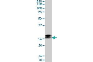 Western Blotting (WB) image for anti-Ring Finger Protein 141 (RNF141) (AA 141-230) antibody (ABIN599236) (RNF141 抗体  (AA 141-230))