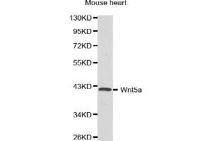 Western Blotting (WB) image for anti-Wingless-Type MMTV Integration Site Family, Member 5A (WNT5A) (AA 101-380) antibody (ABIN3023003) (WNT5A 抗体  (AA 101-380))