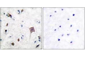 Immunohistochemistry (IHC) image for anti-PTK2B Protein tyrosine Kinase 2 beta (PTK2B) (AA 546-595) antibody (ABIN2888606) (PTK2B 抗体  (AA 546-595))